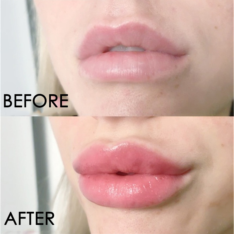 リップケアセラム インスタントボリュームアップ リッププラン - Lip Gloss Plumping のレビューと価格